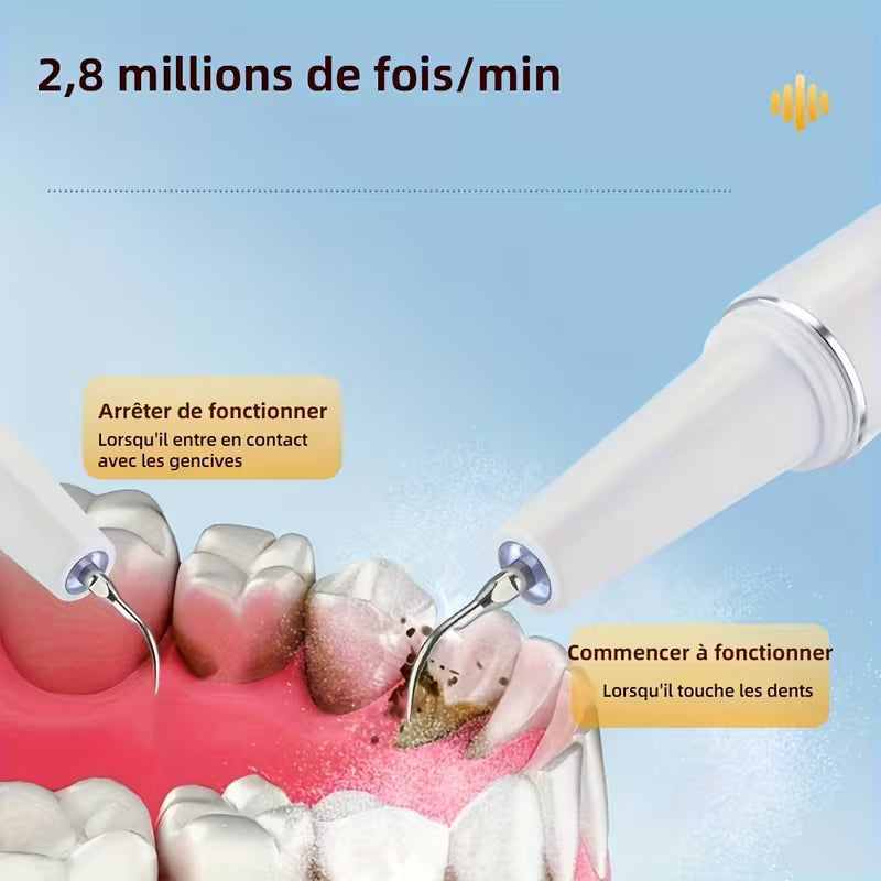 Kit de Détartrage ProClean - Fil Dentaire Électrique avec Lumière LED Réglable à 5 Niveaux, 4 Têtes Remplaçables et Extraction Avancée du Calcul Dental pour une Santé Bucco-Dentaire Améliorée et un Souffle Frais